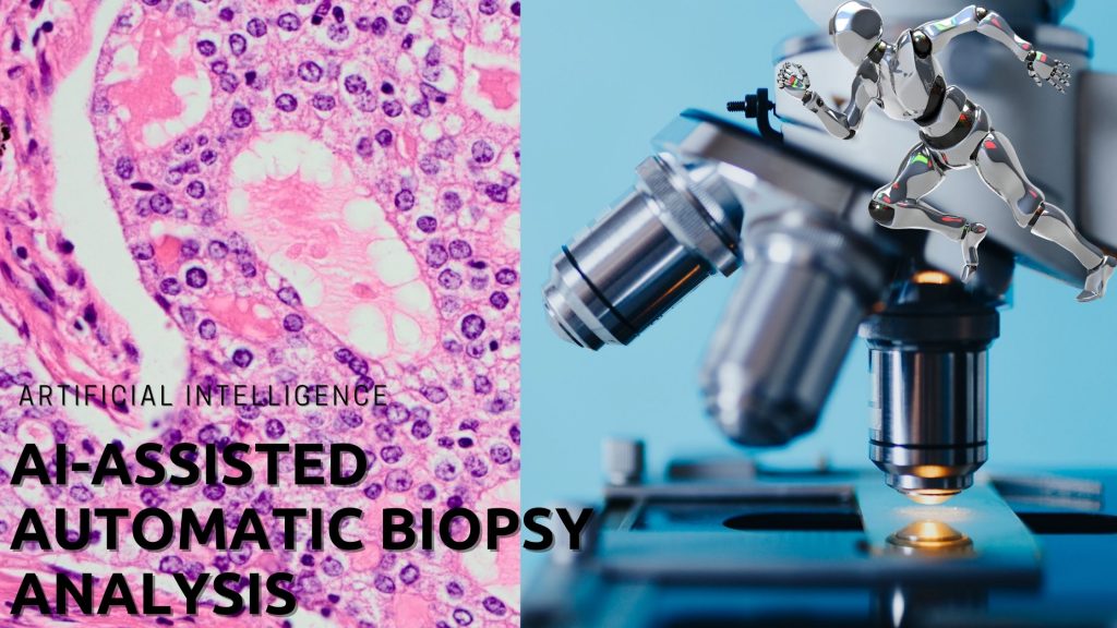 AI-assisted biopsy analysis