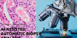 AI-assisted biopsy analysis