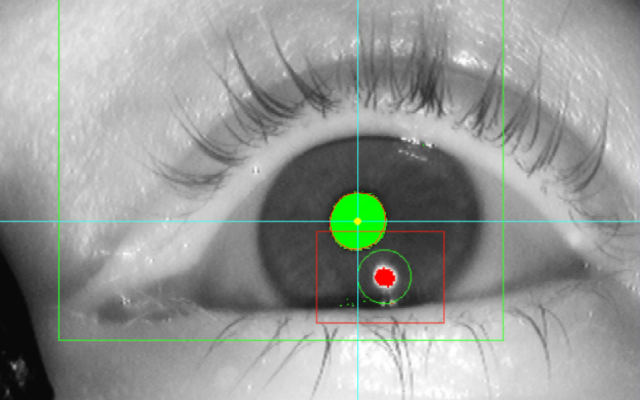 detecting human conditions on eye movements