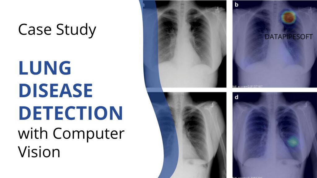 lung disorders detection