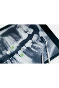 ai dental diagnosis